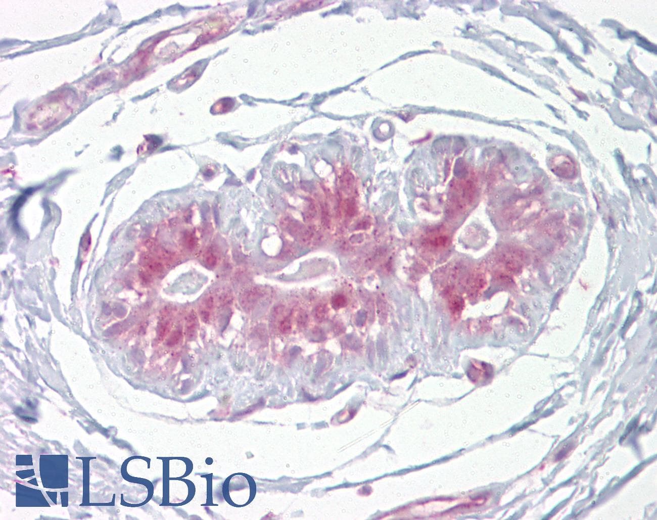 ESE3 / EHF Antibody (aa121-170)