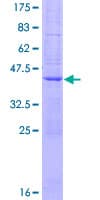 Human ATP9B Protein (Recombinant GST)