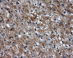 PME-1 / PPME1 Antibody (clone OTI6H5)