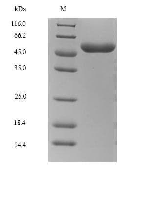 Rabies Virus gG Protein (Recombinant 9His, C-terminus)