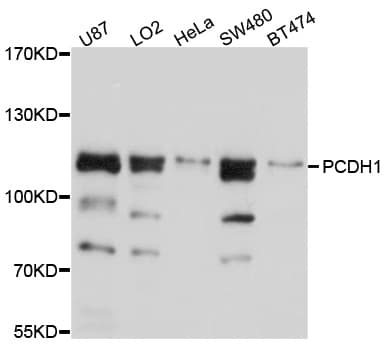 PCDH1 / PCD1 Antibody