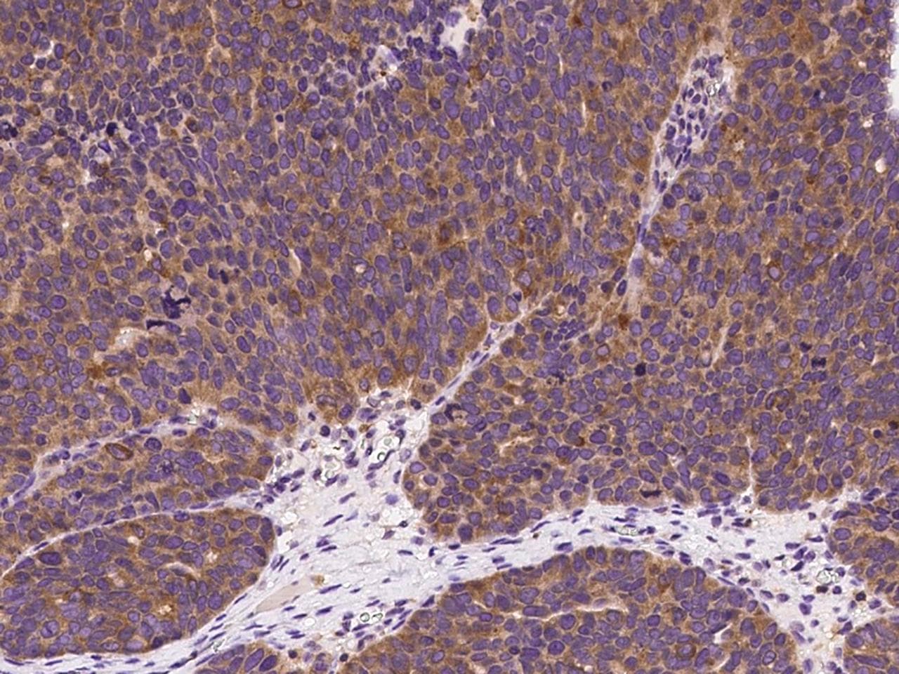 p21-ARC / ARPC3 Antibody