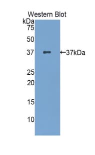ZAP70 Antibody (aa270-560, Biotin)