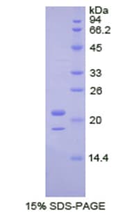 Human TDP-43 / TARDBP Protein (Recombinant His, N-Terminal)