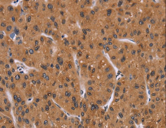 Polyclonal Rabbit anti-Human PPIB / Cyclophilin B Antibody (IHC, WB)