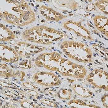 Polyclonal Rabbit anti-Human GSTT1 Antibody (IHC, WB)