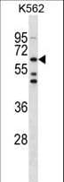 TESK1 Antibody (aa187-215)