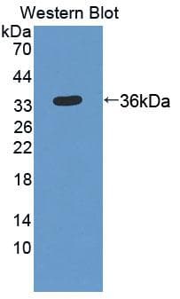 ERGIC-53 / LMAN1 Antibody (aa198-475)