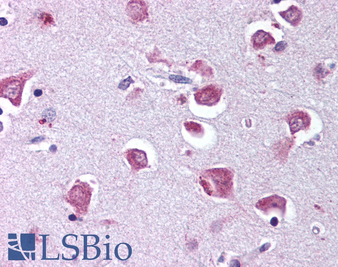 IHC-plus™ Polyclonal Rabbit anti-Human RELA / NFKB p65 Antibody (phospho-Ser529, IHC, WB)
