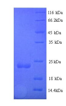 Staphylococcus aureus Staphopain B Protein (Recombinant His)