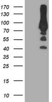 PFKP Antibody (clone OTI5F7)