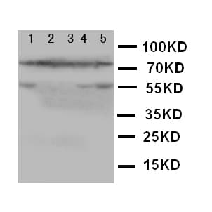 ALOX5 / 5-LOX Antibody (aa650-667)