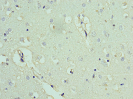 Polyclonal Rabbit anti-Human BAF53B / ACTL6B Antibody (aa1-280, IHC, WB)