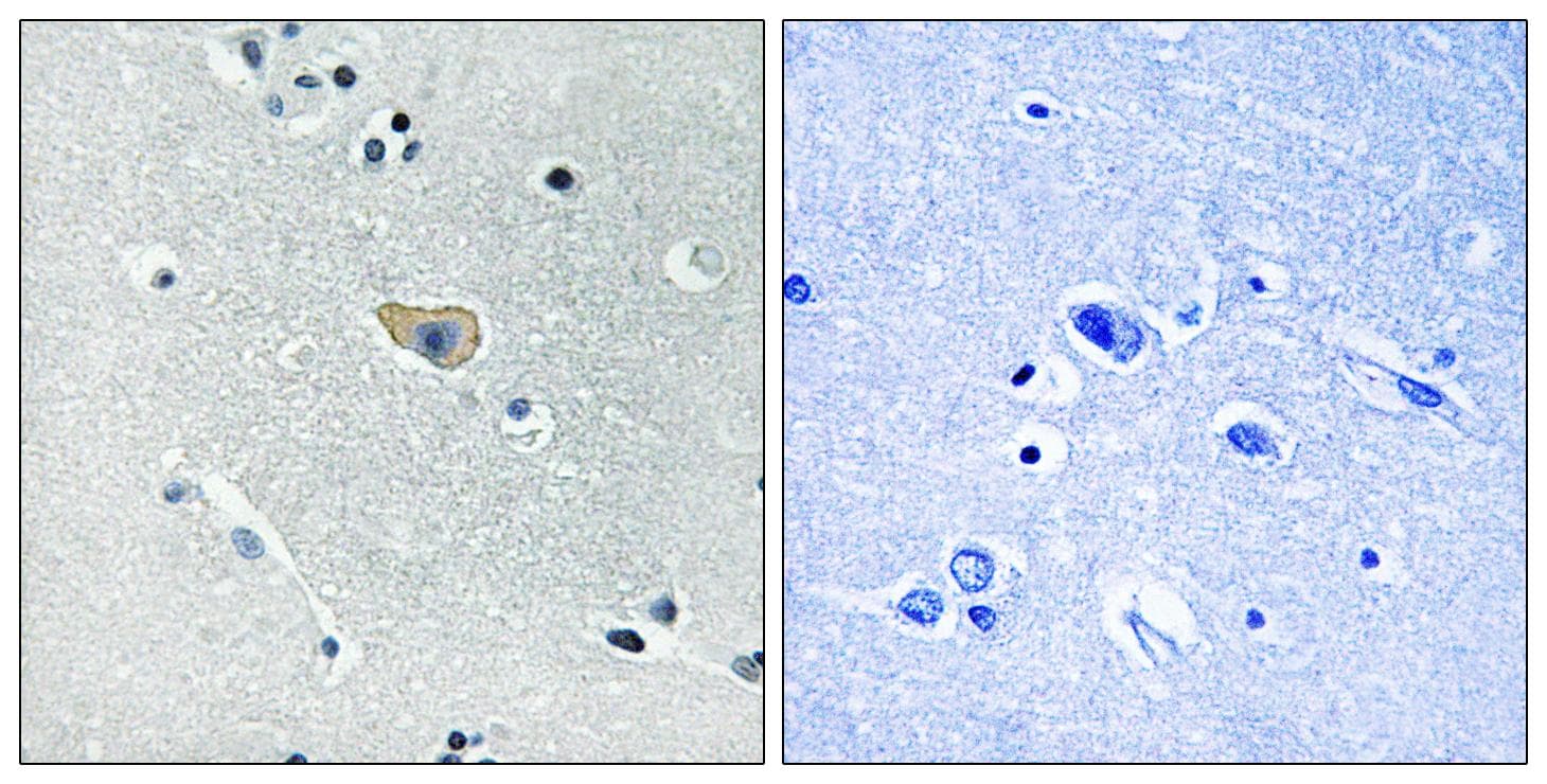 GRIN1 / NMDAR1 Antibody (phospho-Ser890)