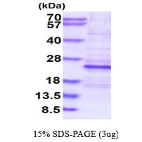 Human LIN28A / LIN28 Protein (Recombinant His)