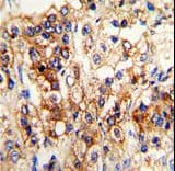 CYP2J2 Antibody (aa96-124)