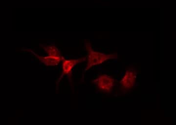 Polyclonal Rabbit anti-Human AGTR1 / AT1 Receptor Antibody (IHC, IF, WB)
