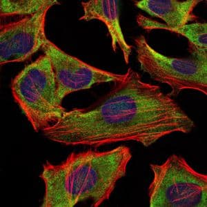 NF-L / NEFL Antibody (clone 1H3)