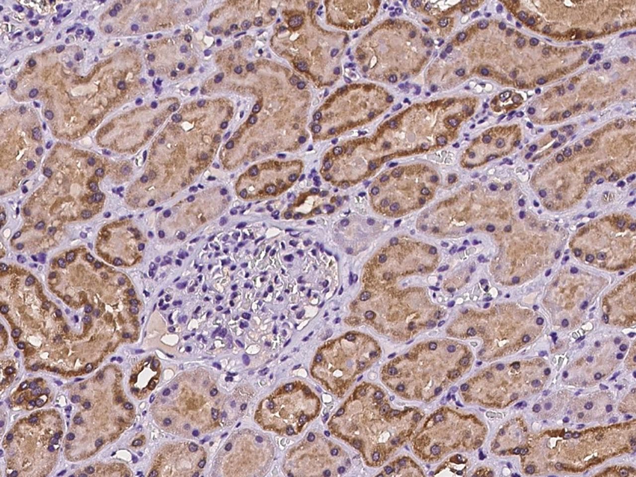 SPINT1 / HAI-1 Antibody
