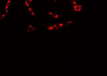 ANOS1 / Anosmin Antibody