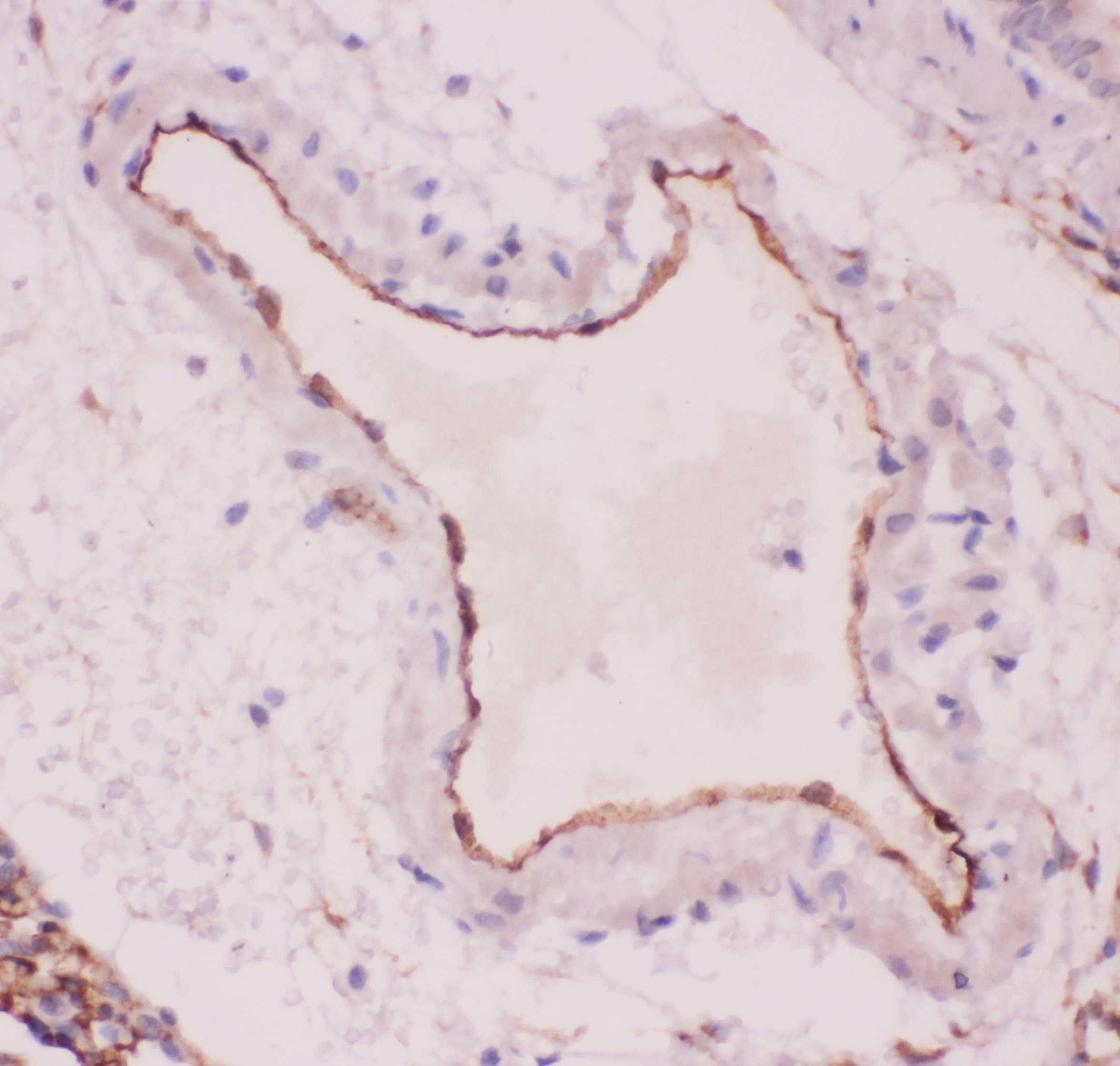 ACE / CD143 Antibody (aa651-864)