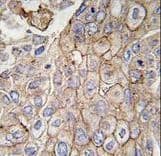 CLIC1 / NCC27 Antibody