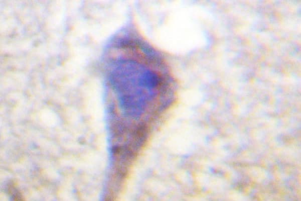 Polyclonal Rabbit anti-Human CML / BCR Antibody (Ser356, IHC)