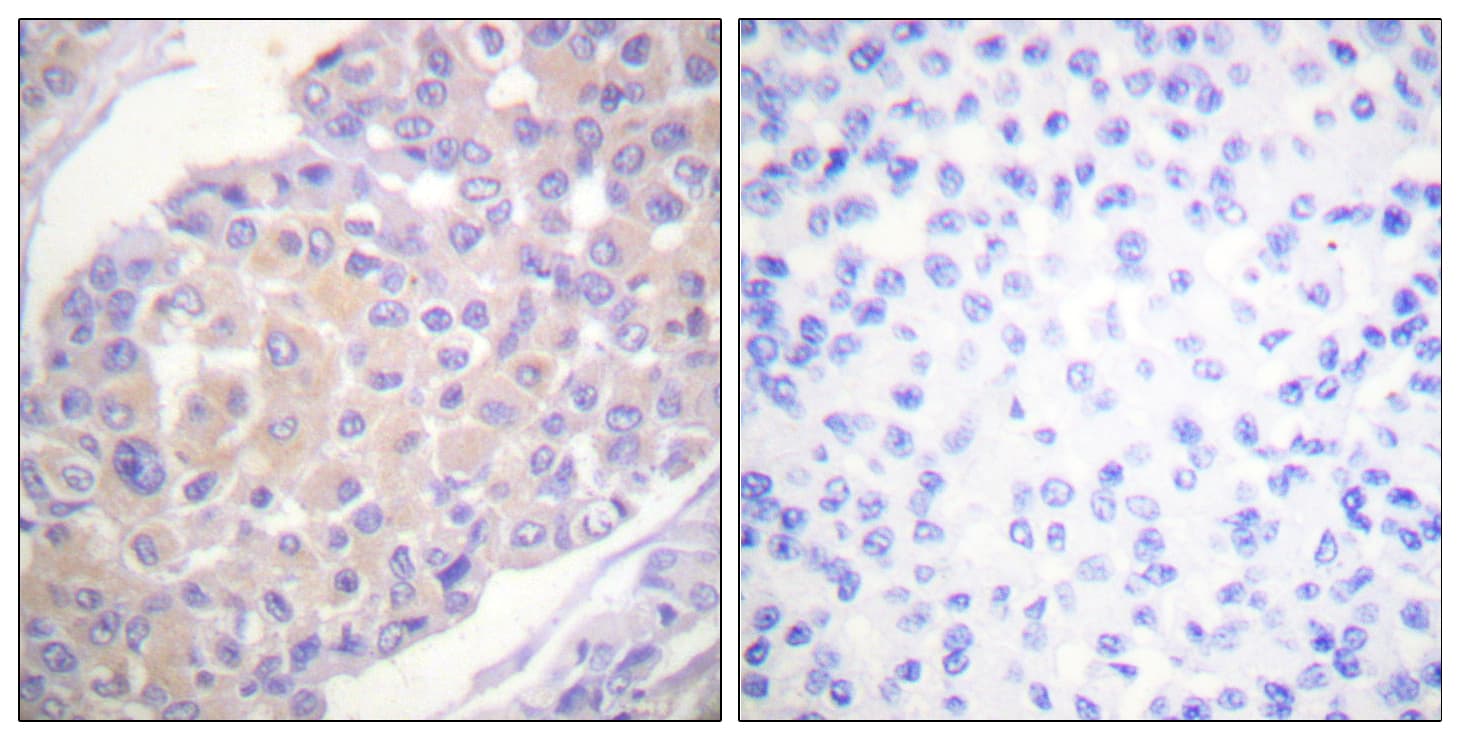 BCAR1 / p130Cas Antibody (phospho-Tyr165)