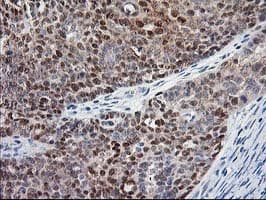 ALS2CR1 / NIF3L1 Antibody (clone OTI2B7)