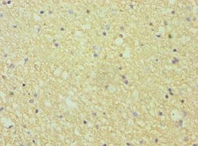 Polyclonal Rabbit anti-Human EFNA1 / Ephrin A1 Antibody (aa19-182, IHC)