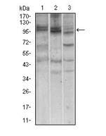NBN / Nibrin Antibody (aa400-650, clone 7E4A2)