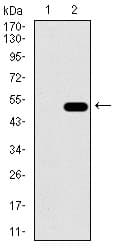 ALDH2 Antibody (aa317-517, clone 4G6A3)