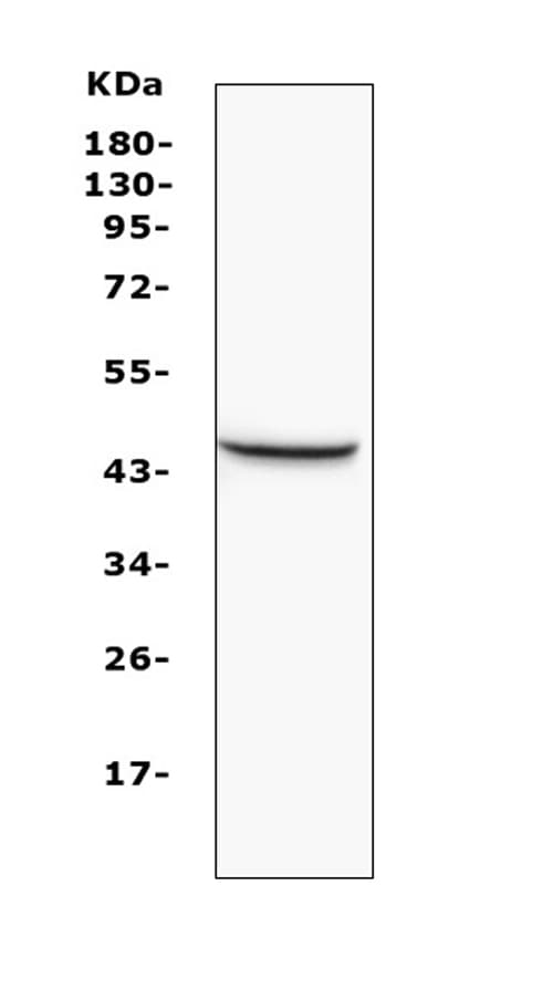 MVD Antibody