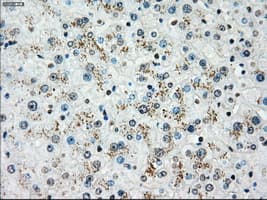 PLK1 / PLK-1 Antibody (clone OTI1A2)