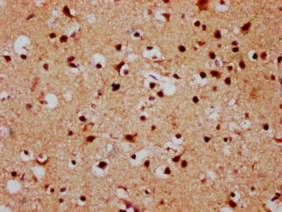 FSD1 Antibody