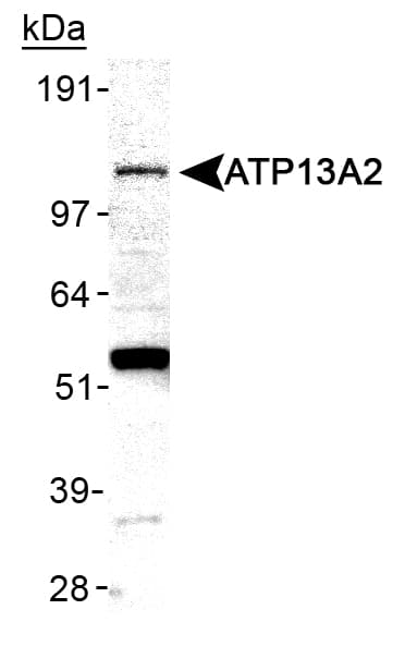 ATP13A2 Antibody (Internal, Biotin)