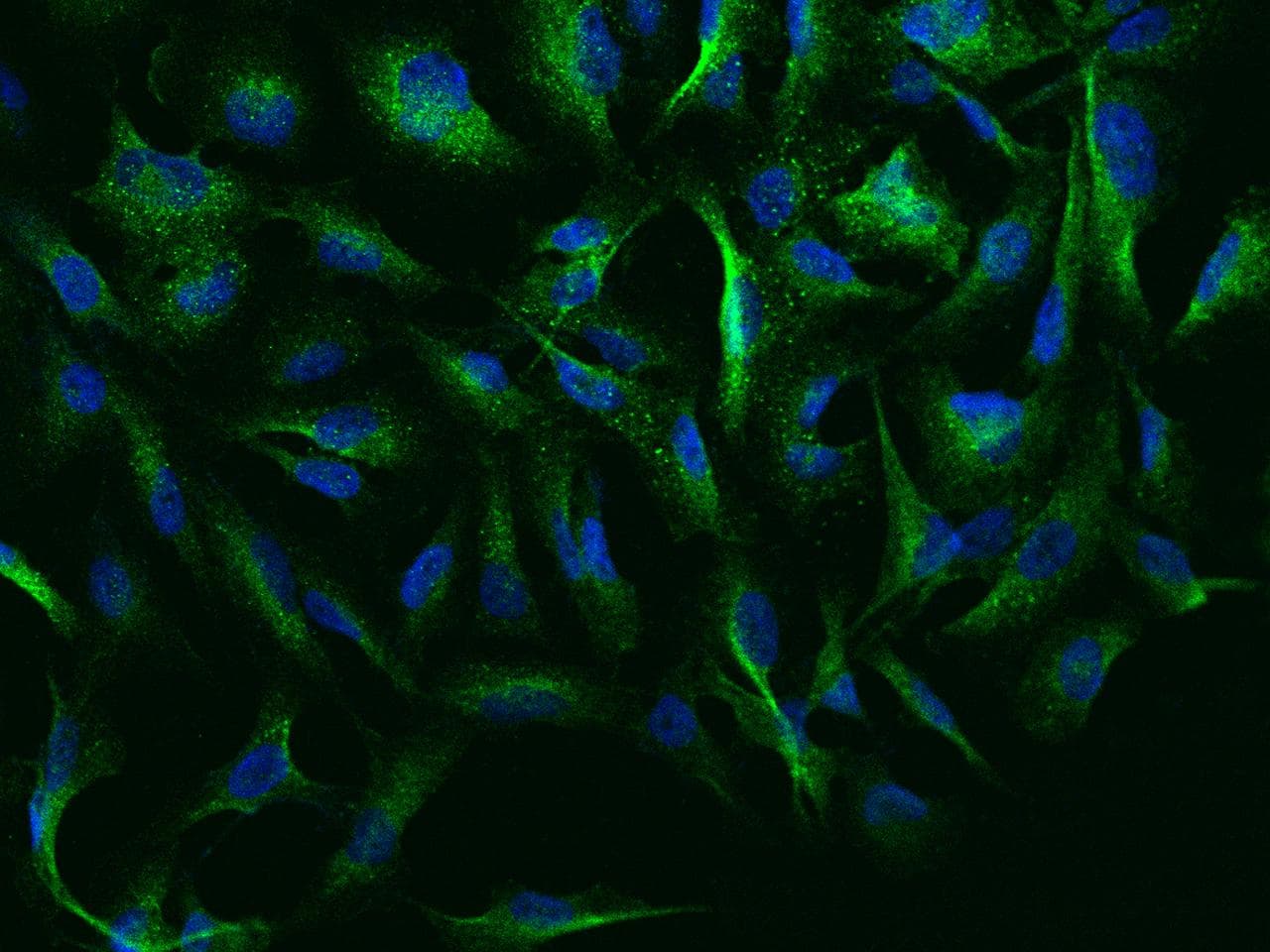 NEURL1 / NEURL Antibody