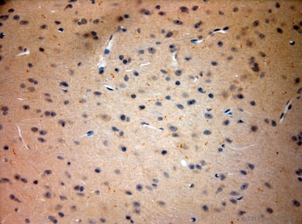 TACR1 / NK1R Antibody (aa150-200)