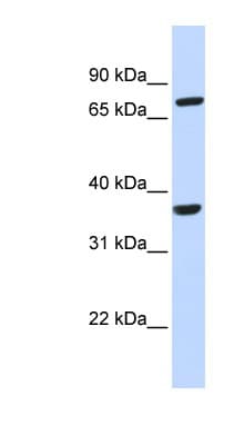 CCRL2 Antibody (aa36-85)