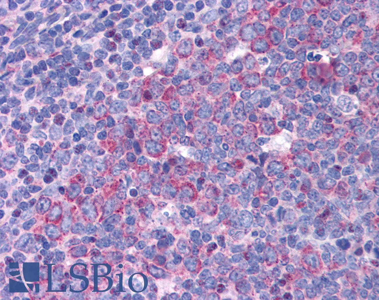 IHC-plus™ EIF5A Antibody (aa13-27)