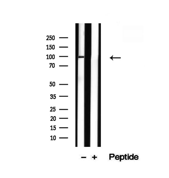 TRPC4AP / TRUSS Antibody