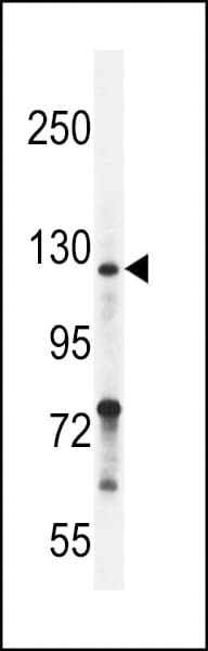 Polyclonal Rabbit anti-Human NRP2 / Neuropilin 2 Antibody (aa798-827, WB)