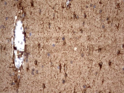 Monoclonal Mouse anti-Human HMBS / PBGD Antibody (clone UMAB144, Carrier-free, IHC, IF, WB)