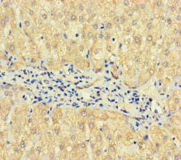 TPTE2 Antibody