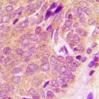 SYK Antibody (C-Terminus)