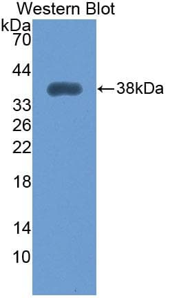 Polyclonal Rabbit anti-Human MYOM2 / Myomesin 2 Antibody (Biotin, aa1130-1434, WB)