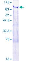 Human ESRP2 / RBM35B Protein (Recombinant GST)