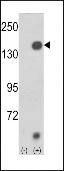 KDM4A / JHDM3A / JMJD2A Antibody (aa527-559)