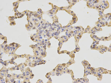 IHC-plus™ SH2D1A / SAP Antibody