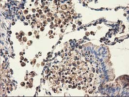 CLPP Antibody (clone OTI1G9)